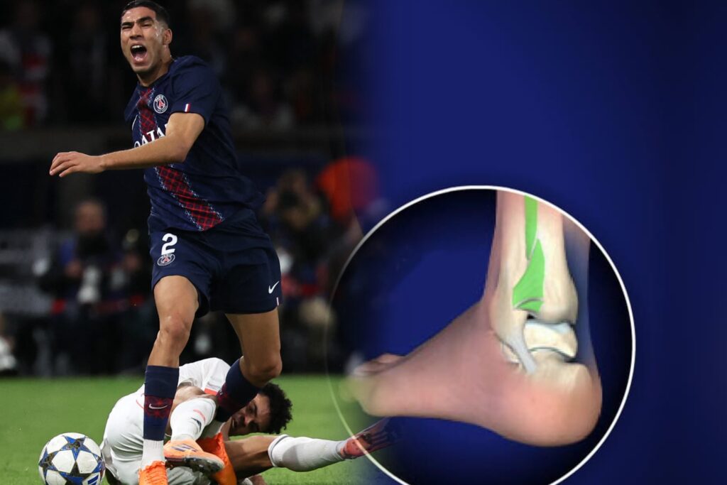 ماركا : إصابة حكيمي تبعده شهرين وتضع مشاركته في كأس إفريقيا على المحك